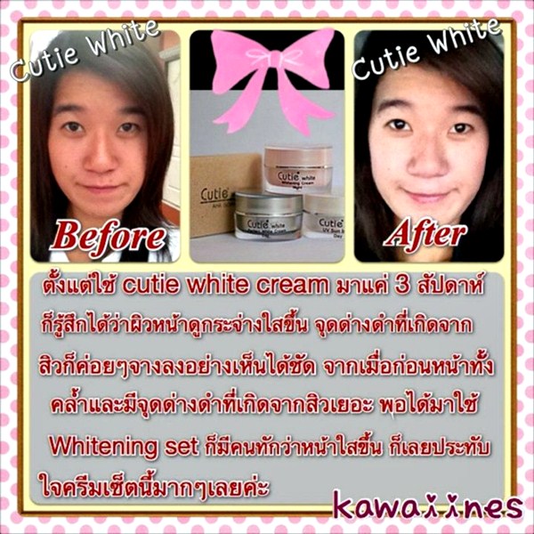 Cutie White Cream ครีมหน้าขาว หน้าใส ไร้สิว