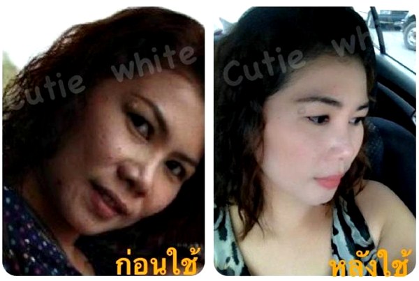 Cutie White Cream ครีมหน้าขาว หน้าใส ไร้สิว