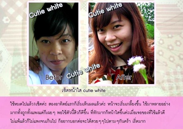 Cutie White Cream ครีมหน้าขาว หน้าใส ไร้สิว