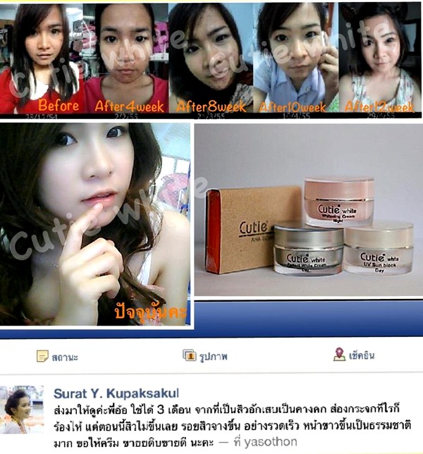 Cutie White Cream ครีมหน้าขาว หน้าใส ไร้สิว