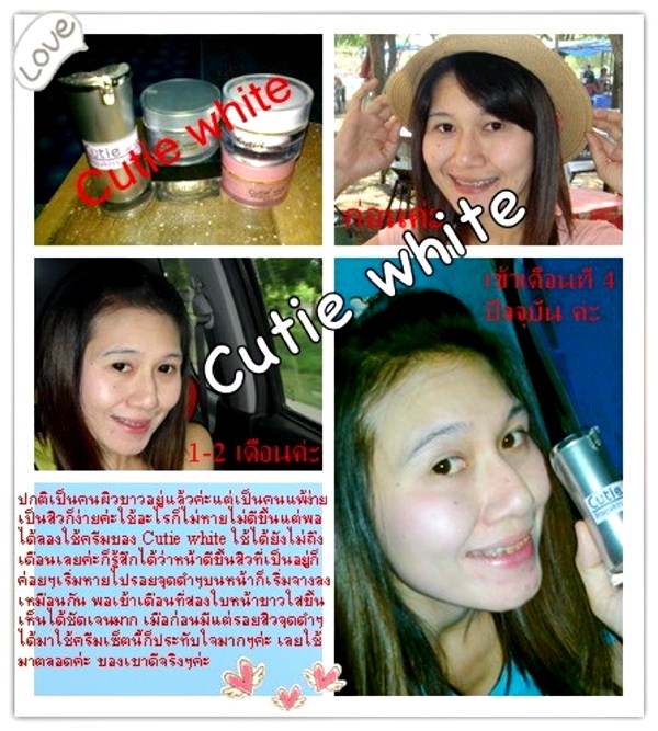 Cutie White Cream ครีมหน้าขาว หน้าใส ไร้สิว